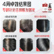 Changfa Xiaozhai Prevention and Deletion Serum Orchidopsis Leaf Polygonum multiflorum ginseng scalp men and women hair care liquid to prevent hair loss in China