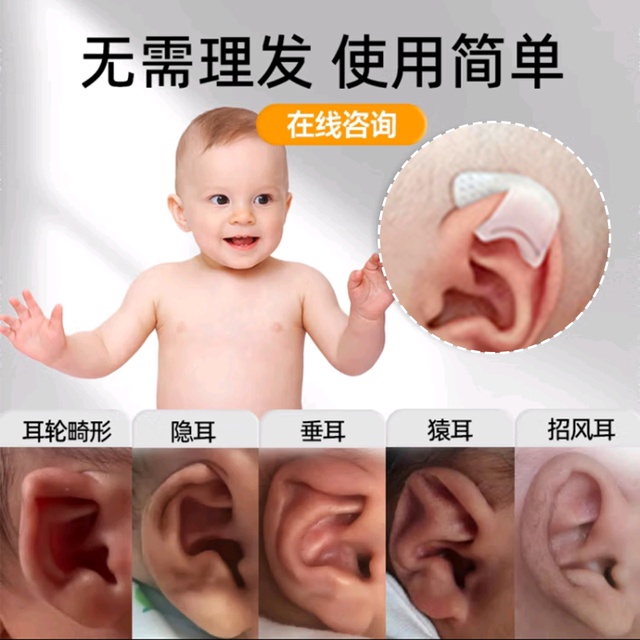 Elf ear patch silicone baby ear corrector veneer ear newborn deformed ear anti-allergy shaping artifact