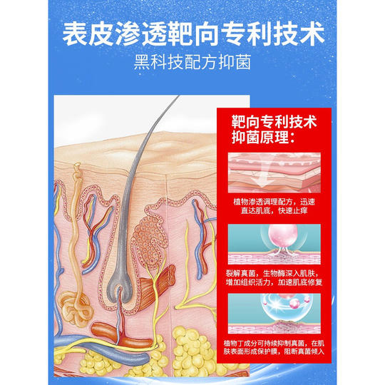 
Special effect skin itchy cream for the whole body to apply hormone-free natural herbal antibacterial cream