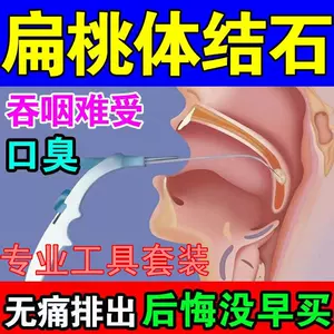 扁桃体结石22年5月 月销口碑最新推荐 天猫淘宝海外 扁桃体结石22年5月 月销口碑最新推荐 天猫淘宝海外