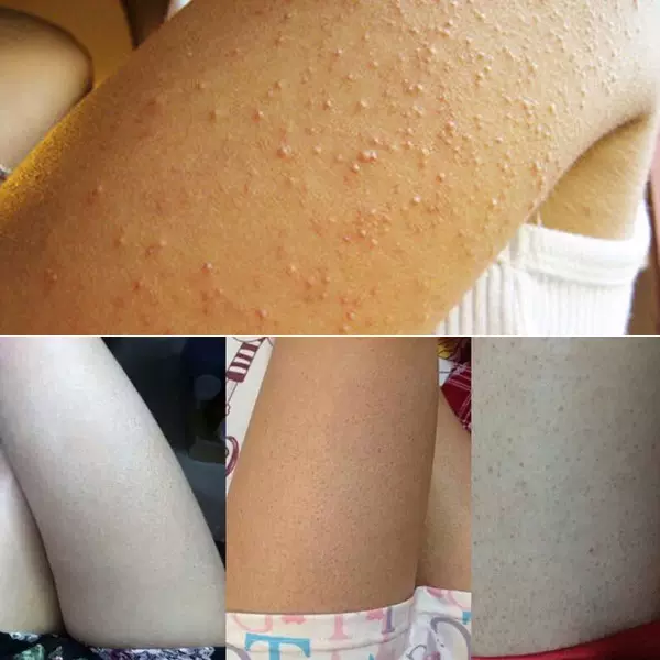 Beely去角质 新人首单立减十元 21年11月 淘宝海外