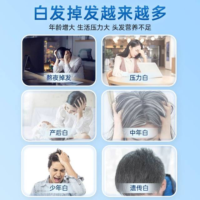 Jiuzhitang iron folic acid tablet white -haired men's pregnant women prepare for pregnant and elderly, vitamin B6 black hair authentic official store
