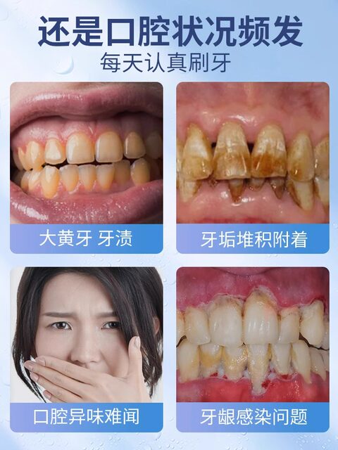 Luha probiotic solid toothpaste portable clean toothpaste tooth yellow tooth stains fresh
