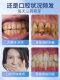 Luha probiotic solid toothpaste portable clean toothpaste tooth yellow tooth stains fresh
