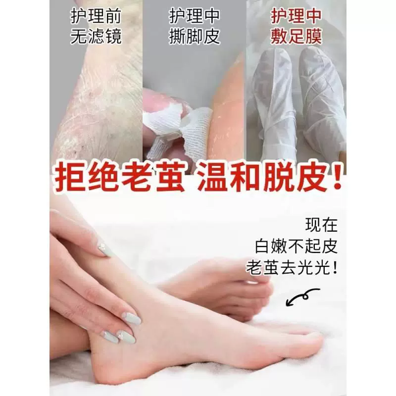羊欧gqj丽源脚死膜套去皮保老茧山奶脱皮