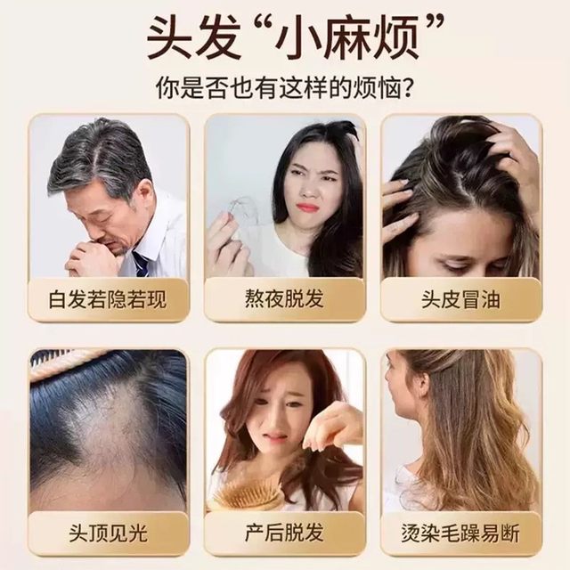 
Biotin anti-hair loss vitamin B vitamin hair loss hair care tablets H