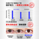 Lutein eye drops to improve vision Eye protection solution to relieve eye pressure and fatigue