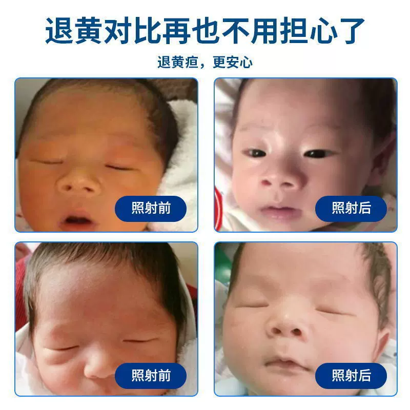 黄疸检测仪家用婴儿-新人首单立减十元-2021年12月淘宝海外