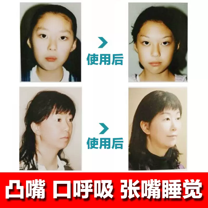 矫正突凸嘴 新人首单立减十元 2021年11月 淘宝海外