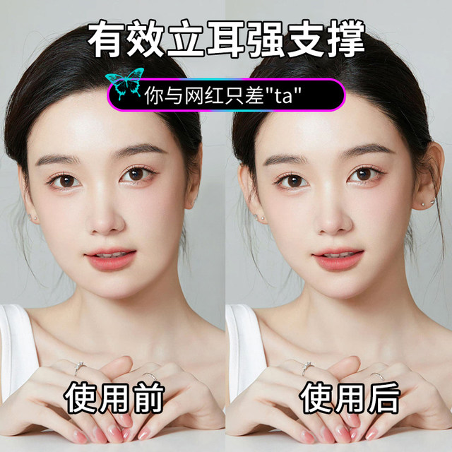 Butterfly Elf ear stickers provide strong support for girls, invisible face-revealing small fixed ear corrector, ear erecting and shaping artifact