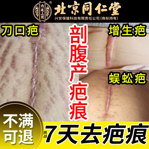 Прозрачный послеродовой бондаж, послеродовой гель, восстанавливающий крем