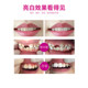 Wilder Depurdent tooth matte particle toothpaste Dr.wild polishing to remove smoke stains and brighten white