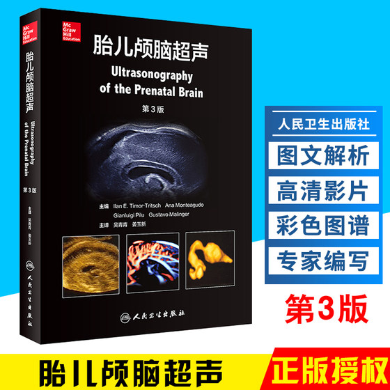 Fetal Cranial Ultrasound 3rd Edition ແປໂດຍ Wu Qingqing ແລະ Jiang Yuxin Imaging Western Medicine Surgery Clinical Diagnosis and Treatment Tools Reference Book Fetal Cranial Fetal Medicine Prenatal Ultrasound Imaging Medicine People's Health Publishing