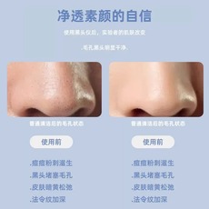 电子美容仪（非器械） 超声波黑头铲子吸黑头神器美容仪脸部毛孔清洁铲皮机紧致按摩导入 No brand