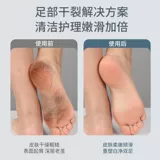 Устройство для шлифовки стоп и удаления омертвевшей кожи, устройство для артефактного педикюра и шлифования ног, устройство для педикюра с мозолями, электрическое устройство для удаления кожи и пяток, педикюр и полировка