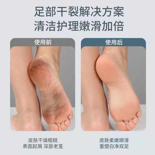 Устройство для шлифовки стоп и удаления омертвевшей кожи, устройство для артефактного педикюра и шлифования ног, устройство для педикюра с мозолями, электрическое устройство для удаления кожи и пяток, педикюр и полировка