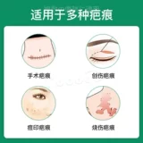 Япония прямая почтовая почта MSD Takada Anti -Scar Ремонт Ремонт РАСПОЛОЖЕНИЕ СДЕЛАТЬ РАСПОЛОЖЕНИЕ СДЕЛАДНАЯ РАСПОЛОЖЕНИЯ РАСПАСКА