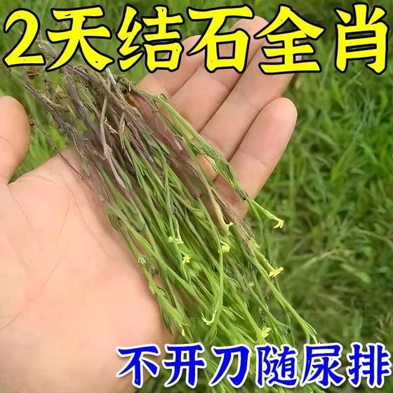 胆囊结石特效药胆结石溶石化石排石专用药胆囊息肉炎绞痛中药贴