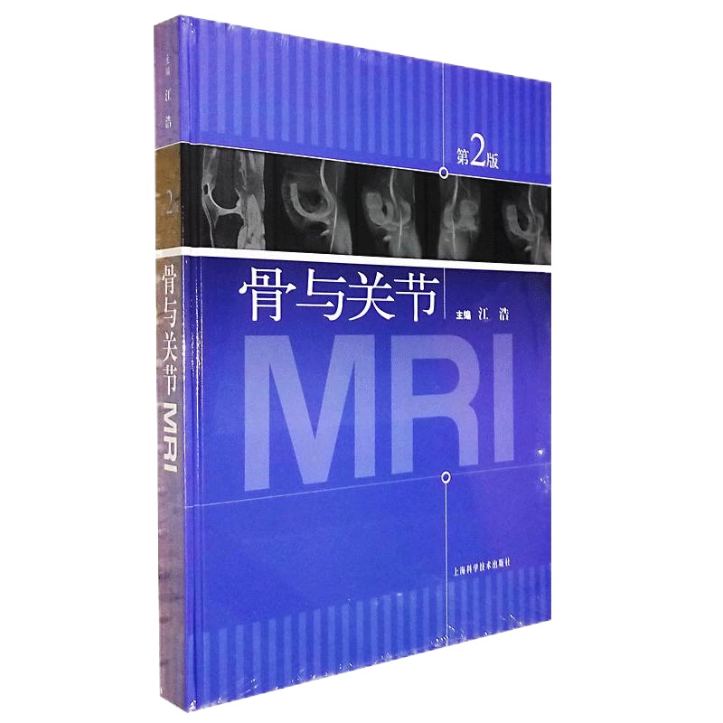 【医学書】関節のMRI 第2版 関節のMRI 第2版 | 福田国彦, 上谷雅孝, 杉本英治, 江原 茂 |本