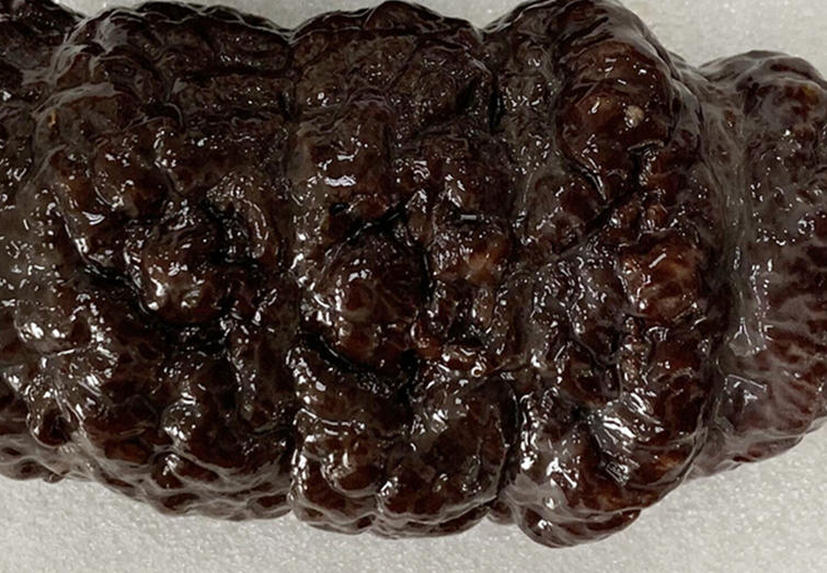 呵护老人健康,北极野生海参为你保驾护航(图3) 呵护老人健康,北极野生海参为你保驾护航(图3)