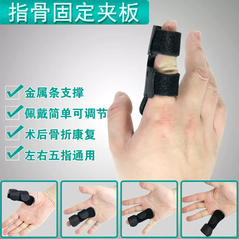 护指扭伤骨折手指夹板固定指套腱鞘受伤保护中指大拇指小指