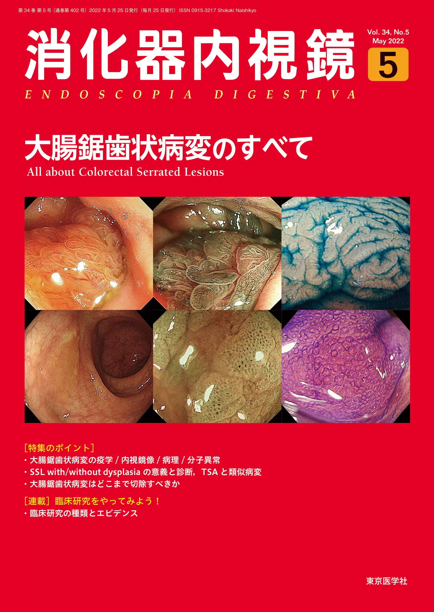 【裁断済】Dr. 平澤俊明の白熱講義実況中継 胃SEL/SMTの診断と治療 購入者限定] Dr.平澤俊明の白熱講義実況中継 胃SEL/SMTの診断と
