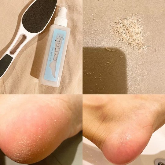Spaluce Foot Spray - Exfoliating Dead Skin Treatment - Made in Japan
