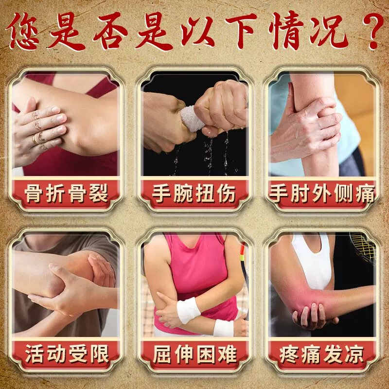 网球肘克星专用非药非治疗胳膊手肘关节疼痛克星非特效非药神器贴