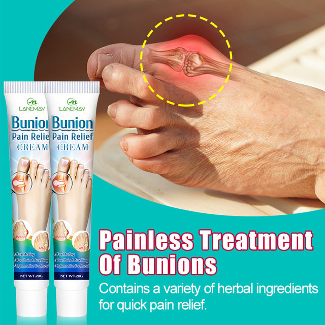 Cross-border Bunion Cream Skin Topical Cream Foot Swelling And Soreness 