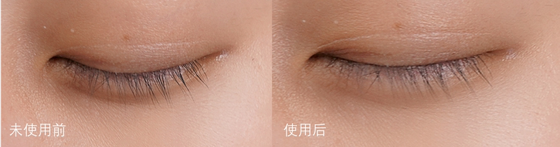 NuFACE FIX,淡化细纹神器轻松say bye bye NuFACE FIX,淡化细纹神器轻松say bye bye
