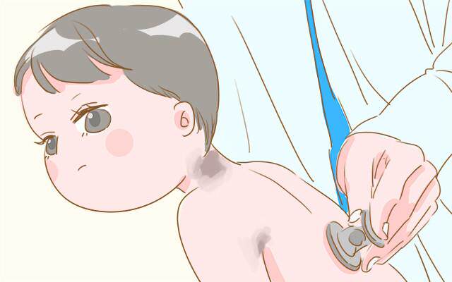 娃脖子出现这情况怎么办教你正确处理