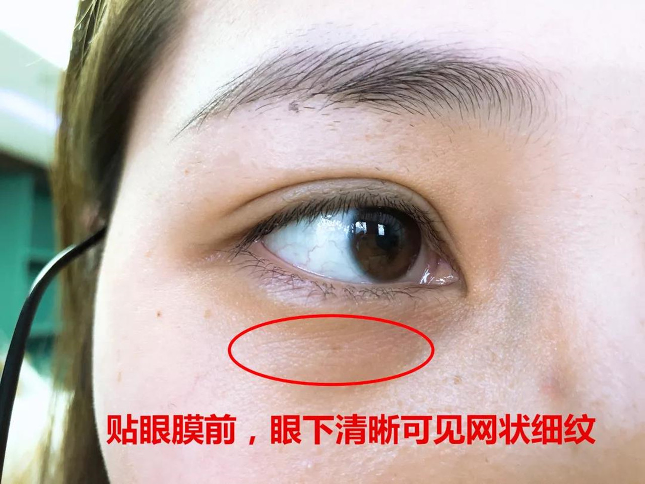 ��������Ĥʲô����������һ�ٷֻ�˦���� ͼ11