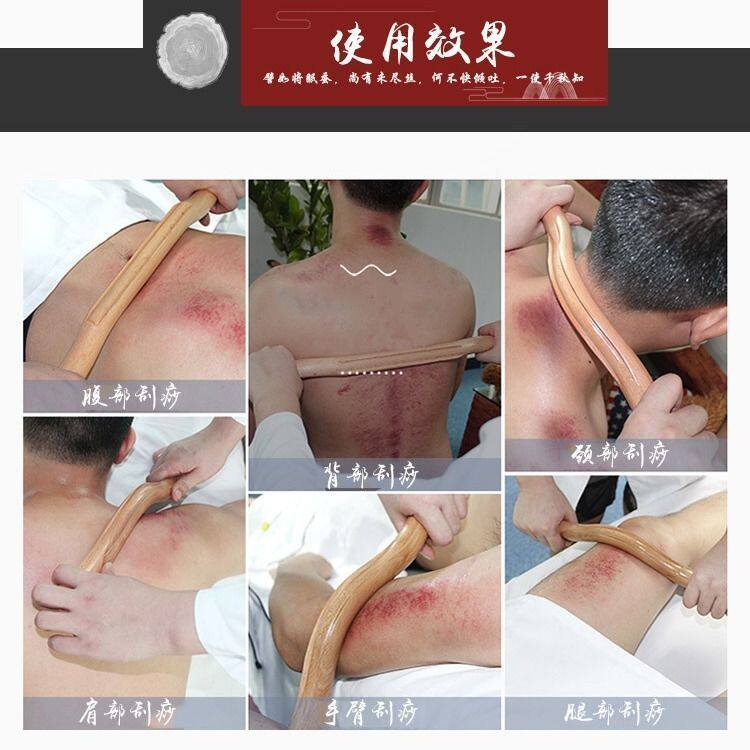 롤링스틱 원목 너도밤나무 미용실 건강 긁기스틱 경락 준설 경추 마사지 스틱 오픈백 스틱 롤링스틱 -