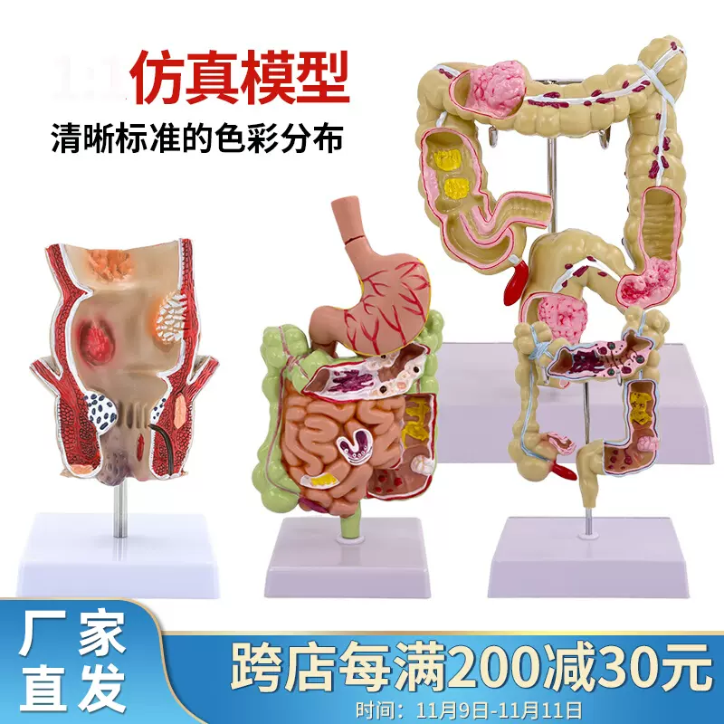 腸解剖模型-