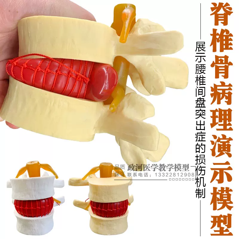 正品醫用人體腰椎間盤演示模型腰椎模型脊柱模型脊椎模型-Taobao