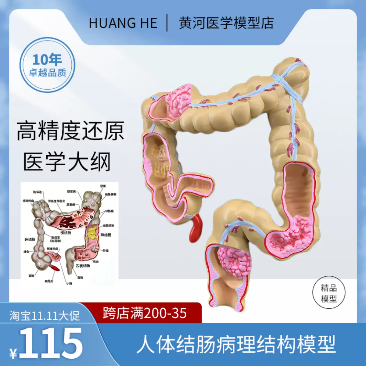 大肠病变病理解剖模型肠道疾病人体结肠病变模型人体器官解剖模型-Taobao