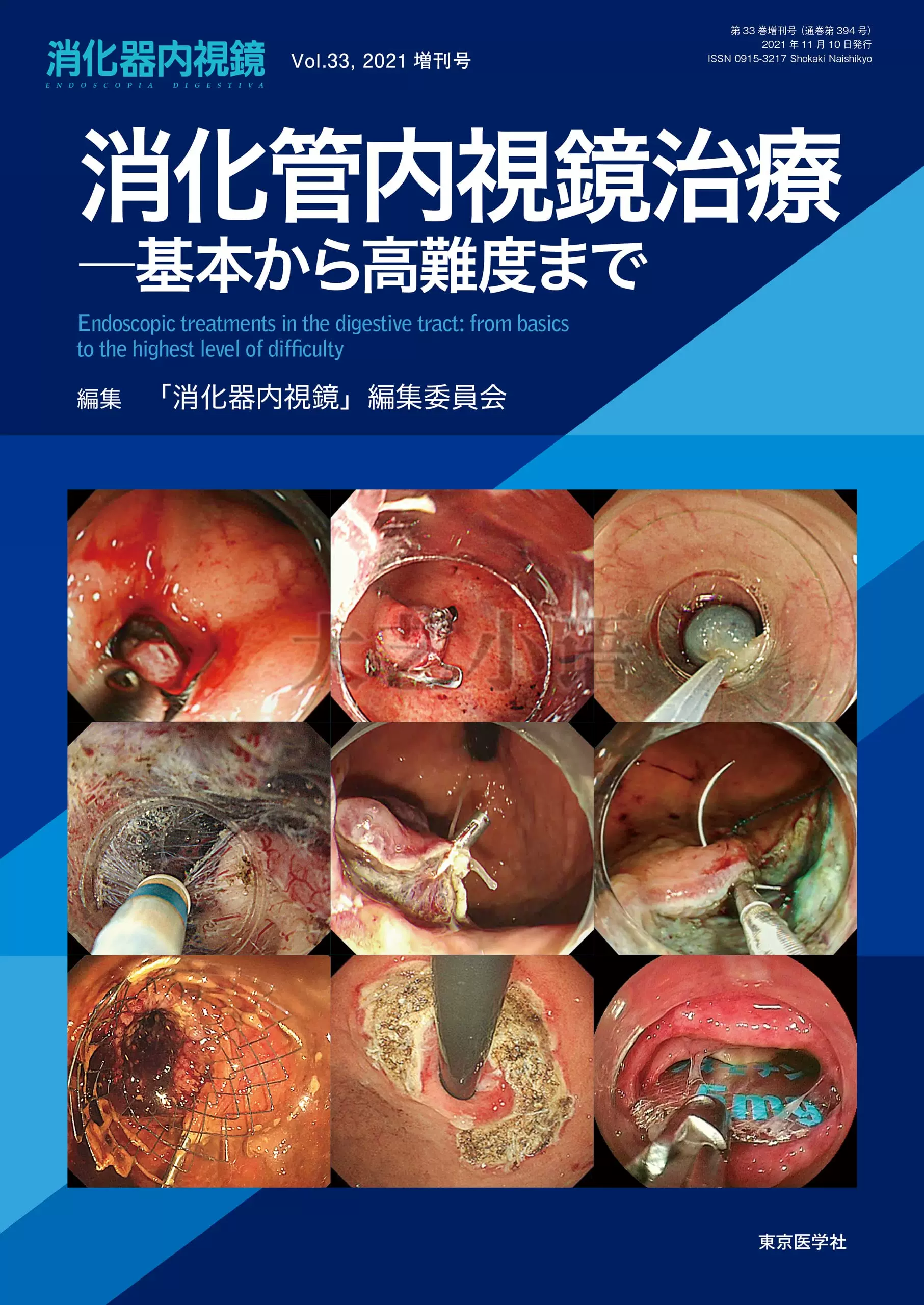 日文原版Dr. 平澤俊明の白熱講義実況中継胃SEL/SMTの診断と治療