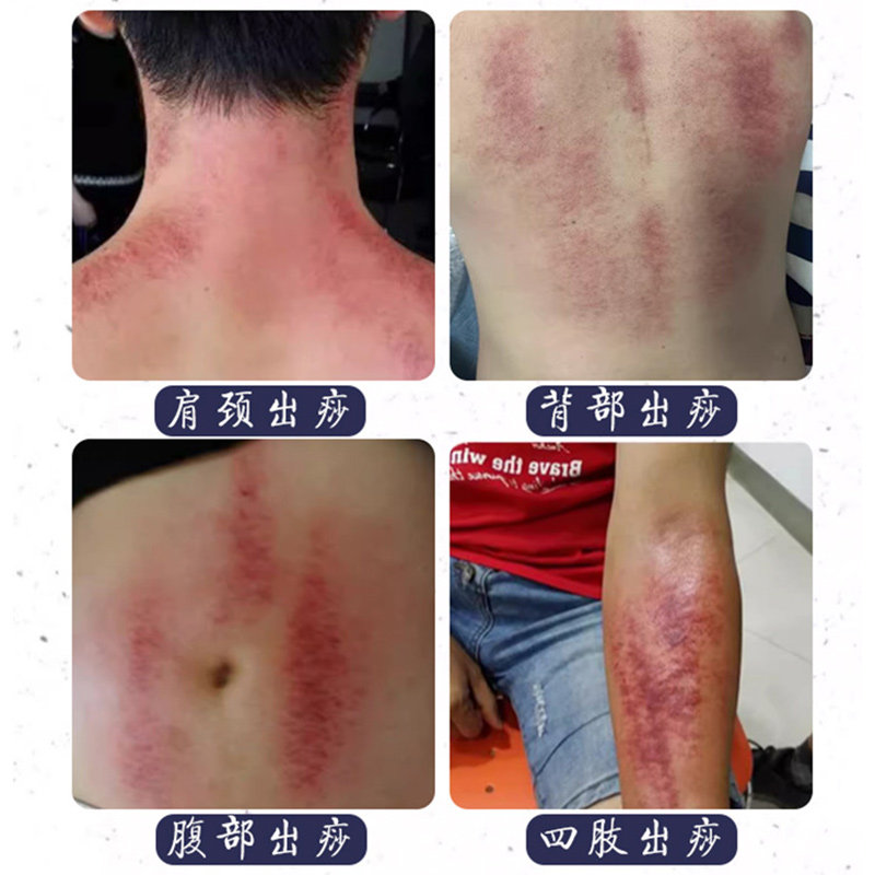 원목 밀대, 긁는 도구, 전신 만능 경락 준설 도구, 긁는 판, 어깨, 목, 허리 전용 도구 -