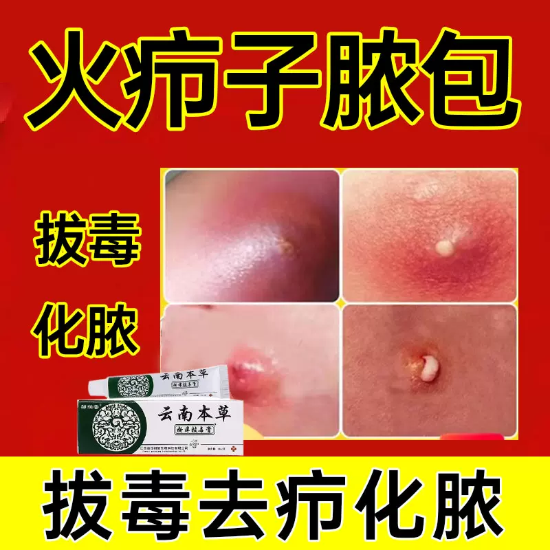 疖子