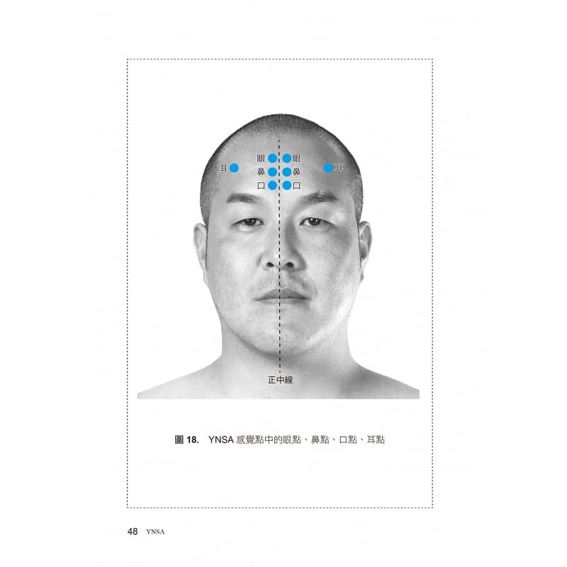 山元民生YNSA鍼灸療法教科書 - 山本俊勝