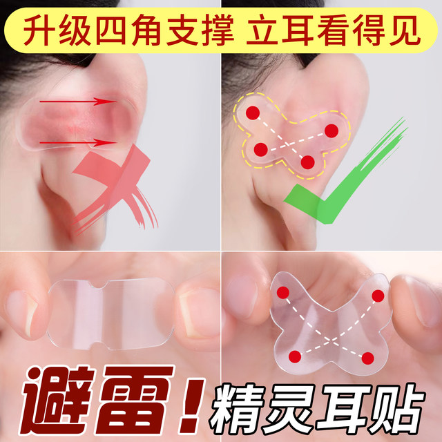 Butterfly Elf ear stickers provide strong support for girls, invisible face-revealing small fixed ear corrector, ear erecting and shaping artifact
