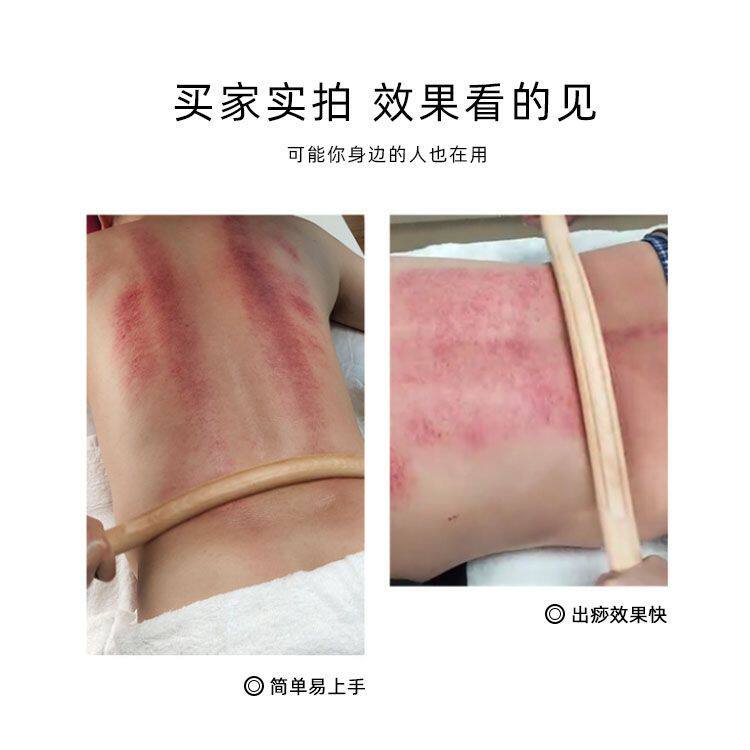 롤링스틱 원목 너도밤나무 미용실 건강 긁기스틱 경락 준설 경추 마사지 스틱 오픈백 스틱 롤링스틱 -