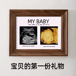 Four-Dimensional Photo Frame for Pregnancy Fetal Nt B-Ultrasound Color Ultrasound Printing Baby Birth Commemorative Photo Display Stand