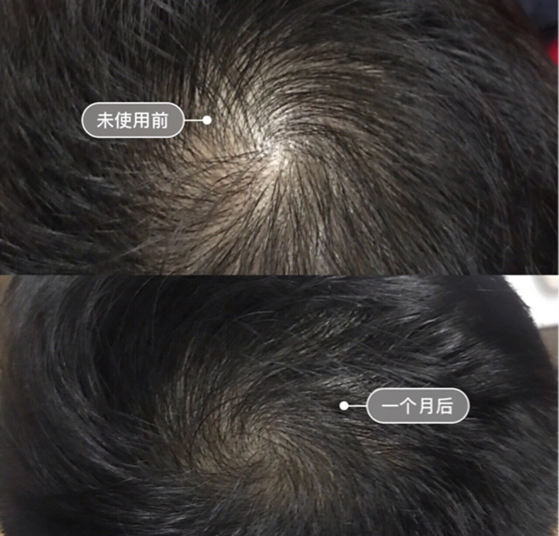 HairMax41�������������� ͼ10