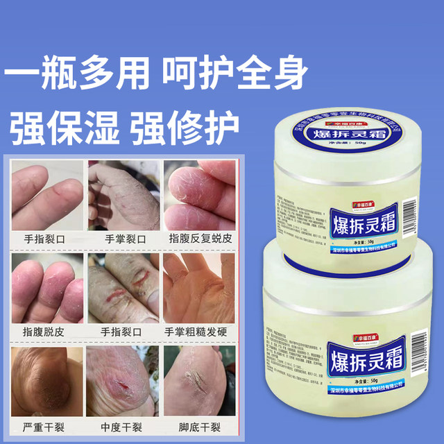 Xingfu Baikang explosive cream moisturizing cream hand cream body ...