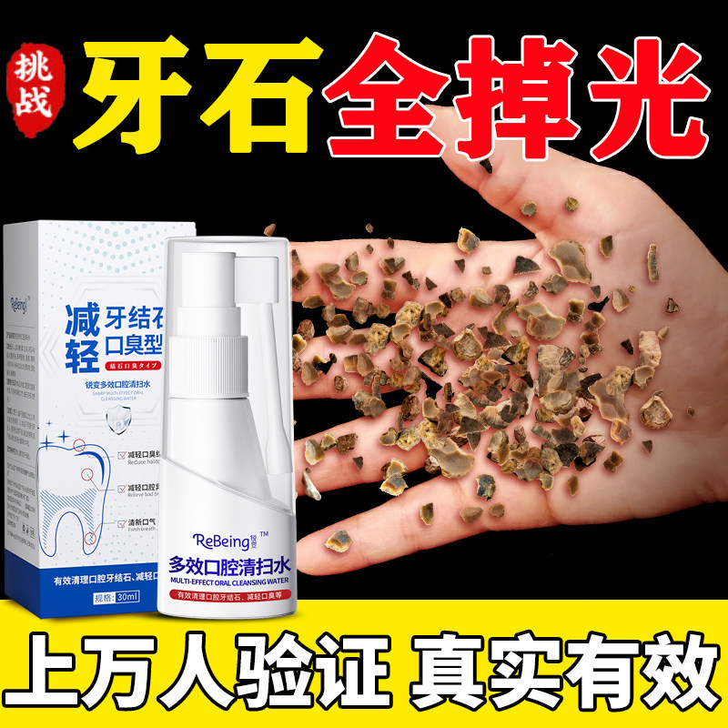 치석 전용 구강세정제, 특수 노란색 치석 치아 불용성 속효성 이물질 제거 및 세척-