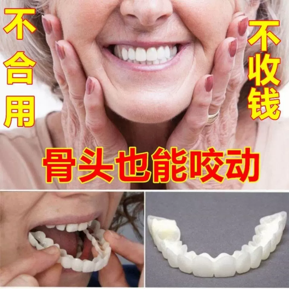 假牙套吃饭防塞牙仿真大门牙临时遮牙套吃饭专用神器美白咀嚼