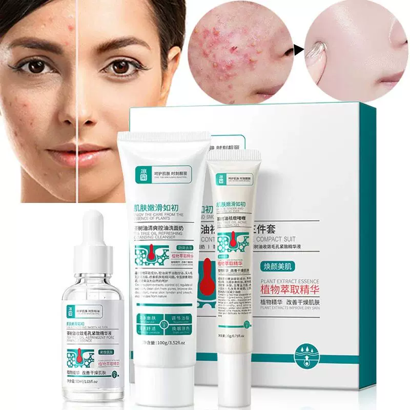 Herbal Acne Removal Face Cream Anti-Acne Gel Pore Shrink Ser-Taobao