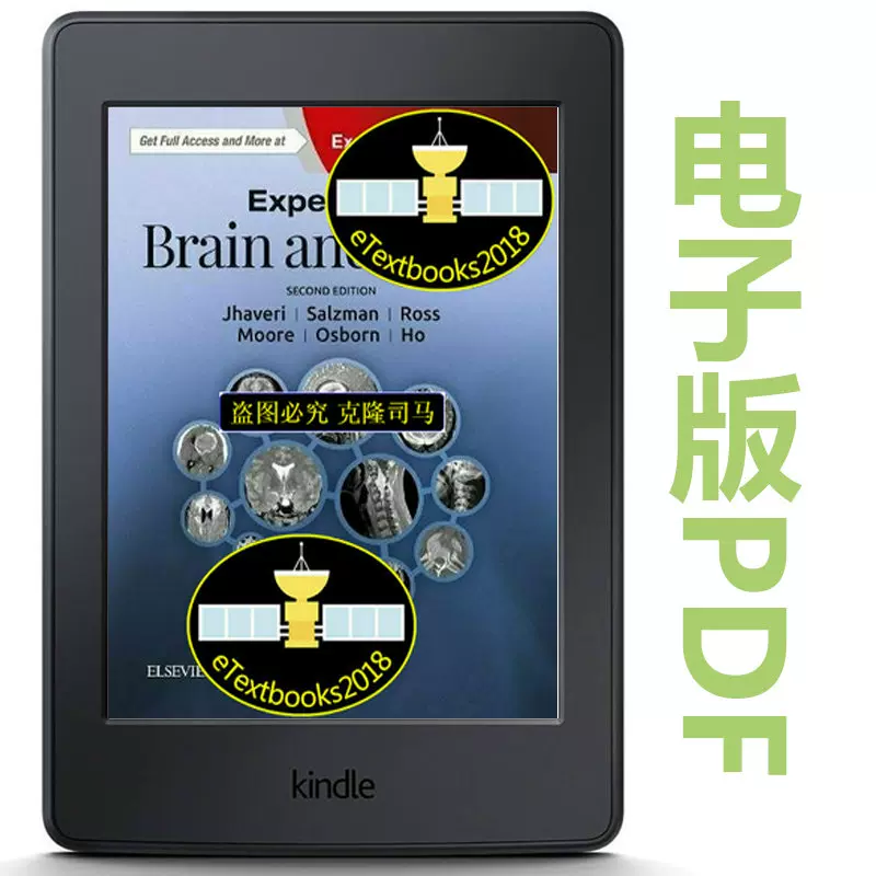 ExpertDDx:Brain and Spine,2nd Edition 原版-Taobao