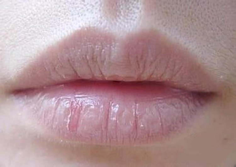嘴唇干裂起皮怎么破三招还你柔嫩美唇